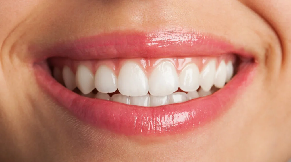 Mükemmel Gülümsemeye Ulaşmak: 7 Temel İlke · Livera Dental Clinic Florya İstanbul