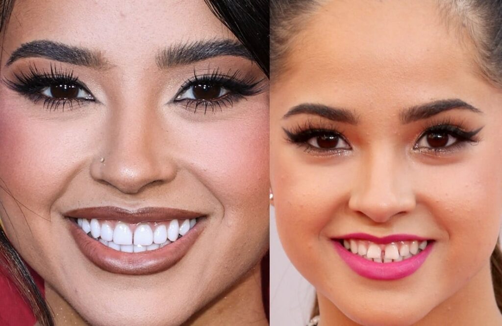 Becky G Dişlerinin Arkasındaki Bilim ve Gülümsemenin Psikolojisi · Livera Dental Clinic Florya İstanbul
