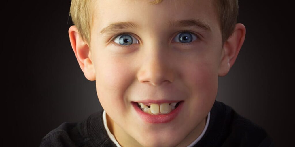 Toothlessness: Causes & Treatment Methods · Livera Dental Clinic Florya Istanbul