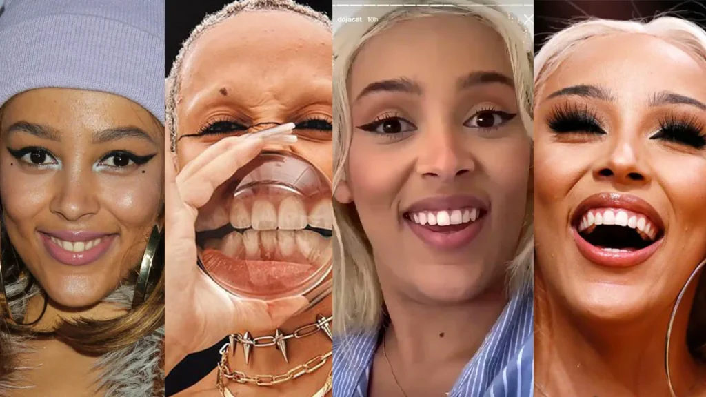 Doja Cat Teeth Evolution and the Aesthetic Journey · Livera Dental Clinic Florya Istanbul