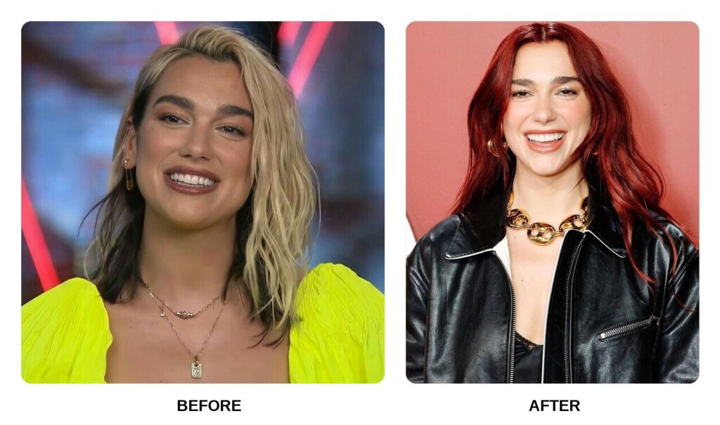 Dua Lipa Teeth: A Cultural Spark Turning Into a Modern Aesthetic Fascination · Livera Dental Clinic Florya Istanbul