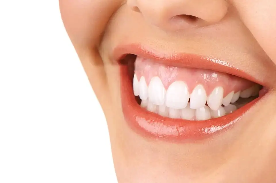 Gummy Smile (Diş Eti Gülüşü): Nedenleri, Tedavi Yöntemleri ve Merak Edilenler · Livera Dental Clinic Florya İstanbul