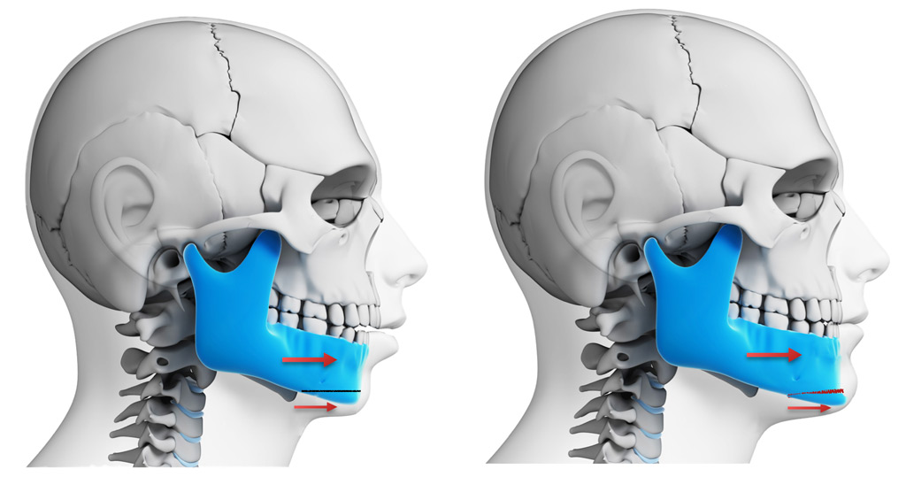Improve Your Oral Health with Jaw Surgery · Livera Dental Clinic Florya Istanbul