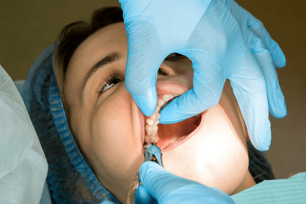 How Many Teeth Can Be Extracted at the Same Time? · Livera Dental Clinic Florya Istanbul