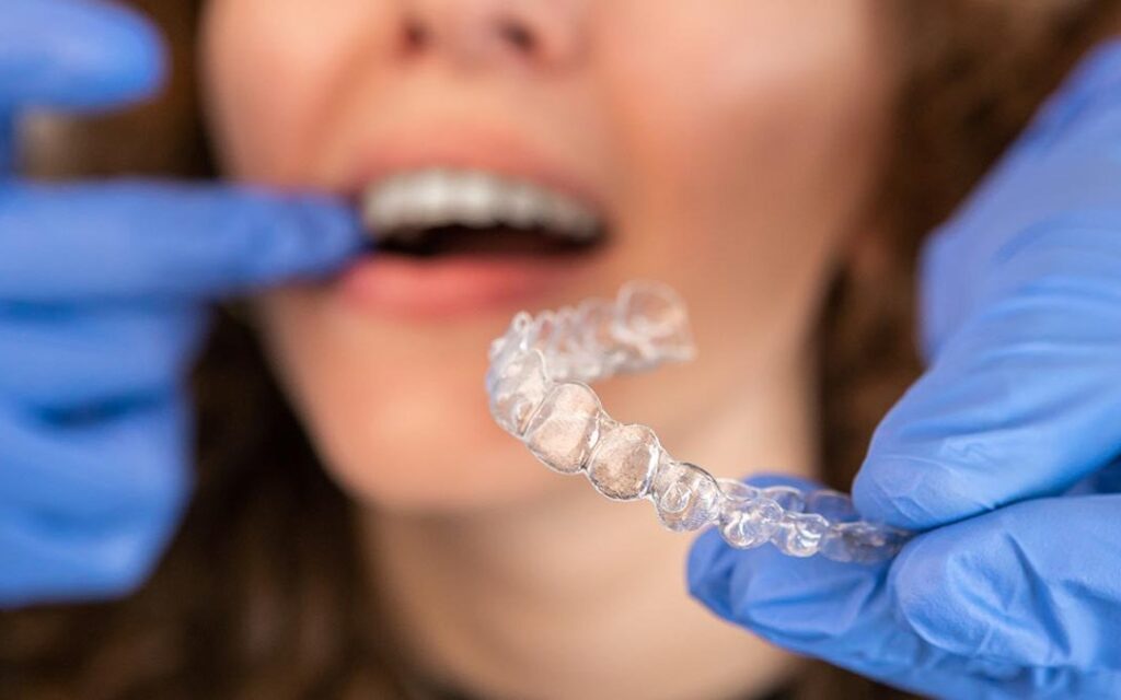 How to Detect Tooth Transparency and 3 Different Treatment Methods · Livera Dental Clinic Florya Istanbul