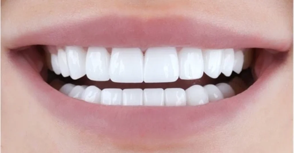 Turkey Teeth и светлая сторона стоматологического туризма в Турции · Livera Dental Clinic Флория Стамбул