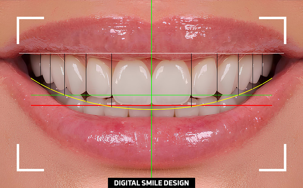 What You Need to Know About Dental Tourism in Turkey · Livera Dental Clinic Florya Istanbul
