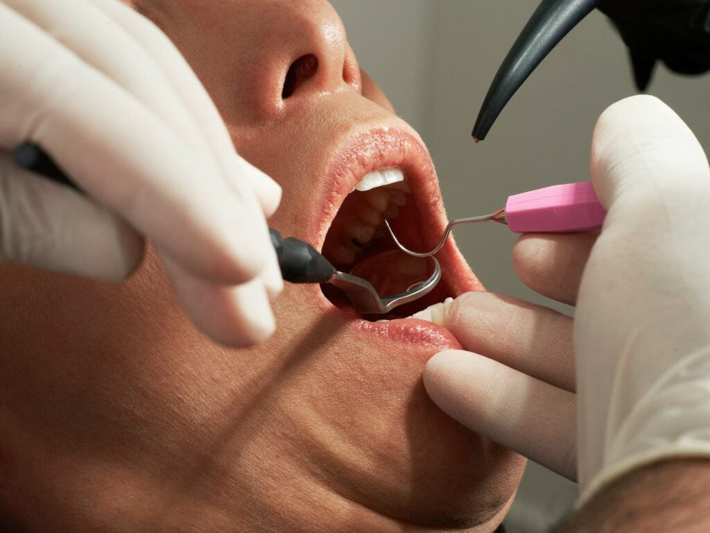 What Causes Bad Breath? How Can It Be Treated? · Livera Dental Clinic Florya Istanbul