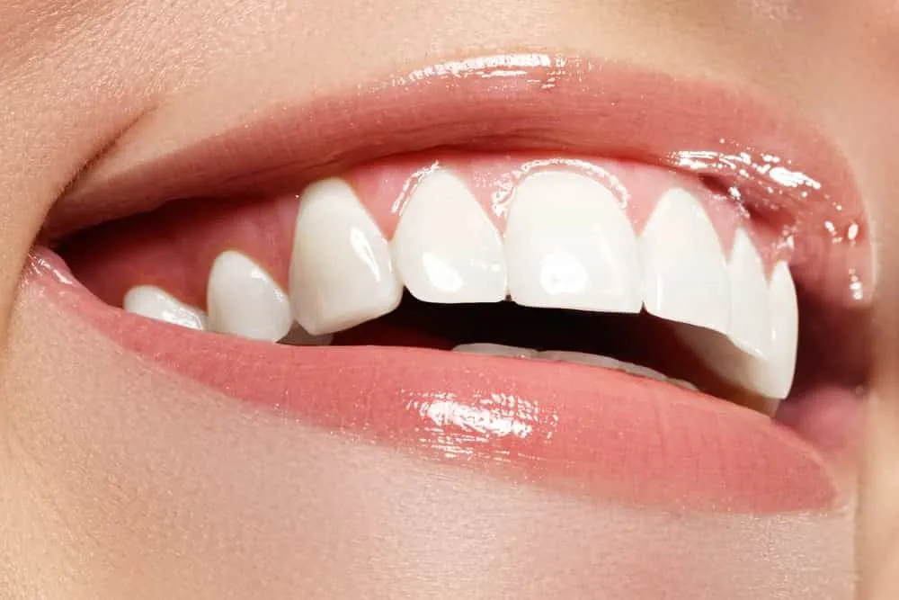 Hollywood Smile Design Procedure in Turkey · Livera Dental Clinic Florya Istanbul