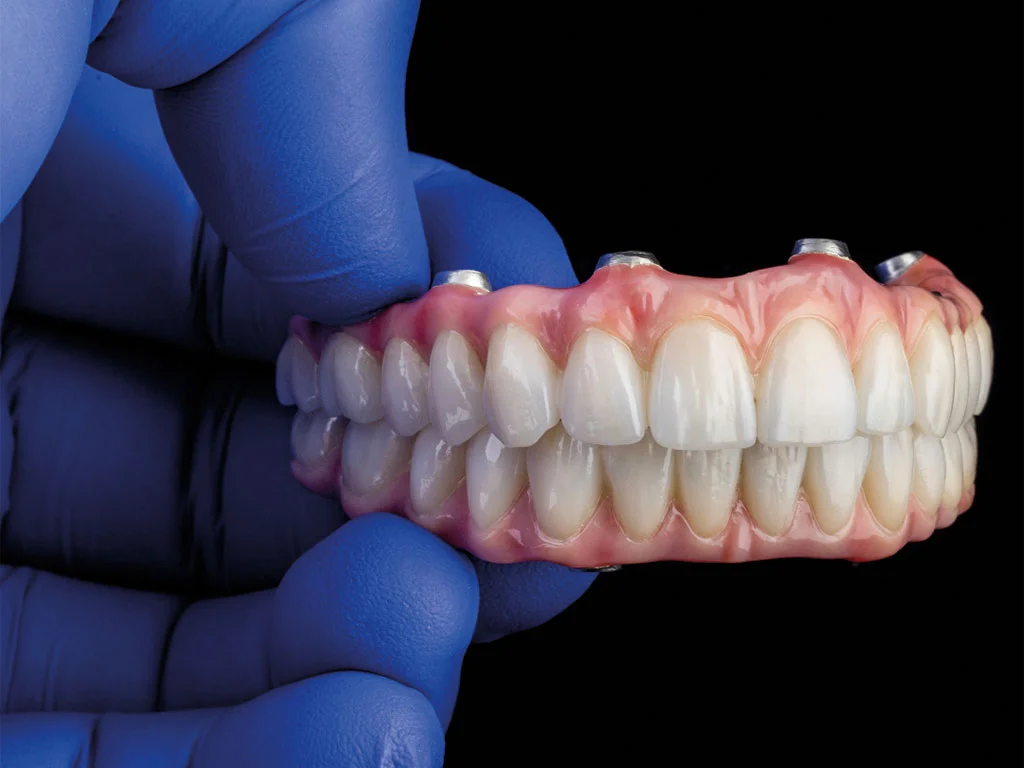 all on four What is the All on Four Implant Technique? · Livera Dental Clinic Florya Istanbul