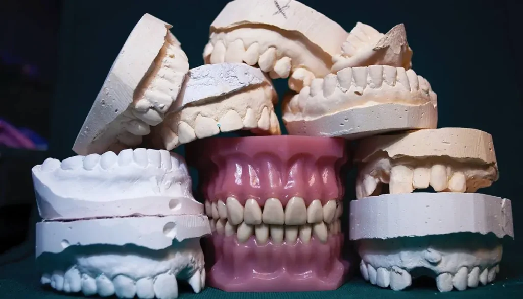 Protezlere Alternatif Diş Tedavileri · Livera Dental Clinic Florya İstanbul