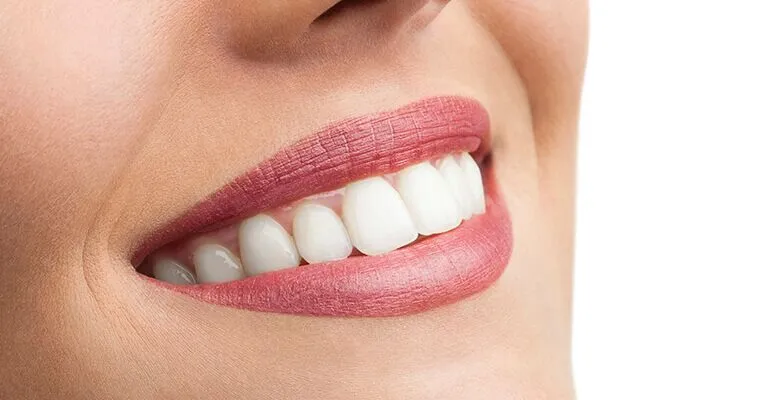 How to Make Your Teeth Whiter: Effective Methods and Tips · Livera Dental Clinic Florya Istanbul