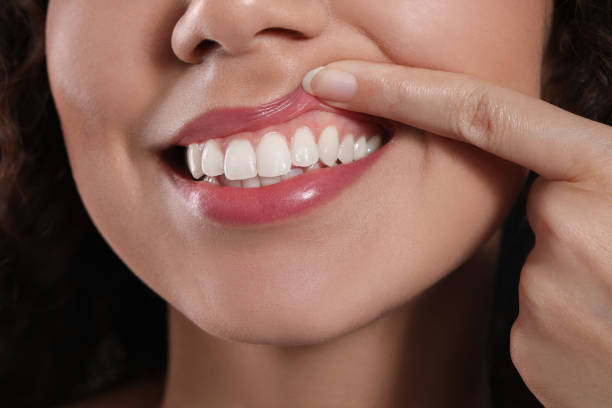 What Helps with Gum Recession?
