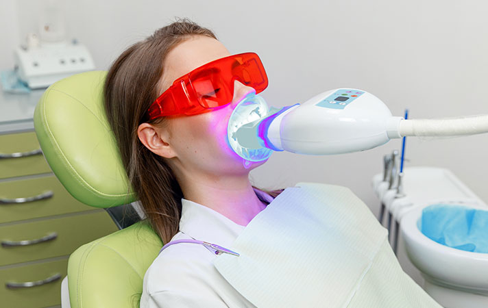 office teeth whitenning