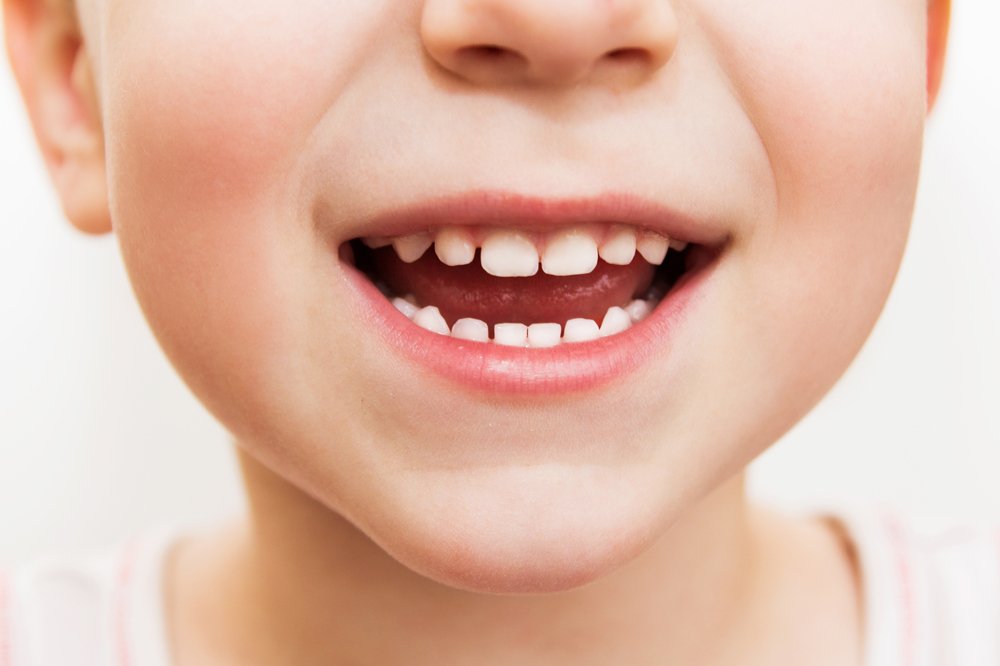 How to Fix Pacifier Teeth? 2 Methods That Work