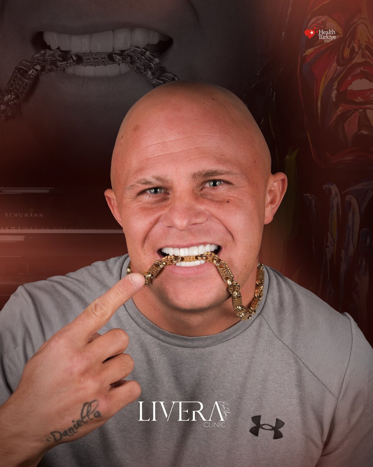 E-Max коронки - Livera Clinic