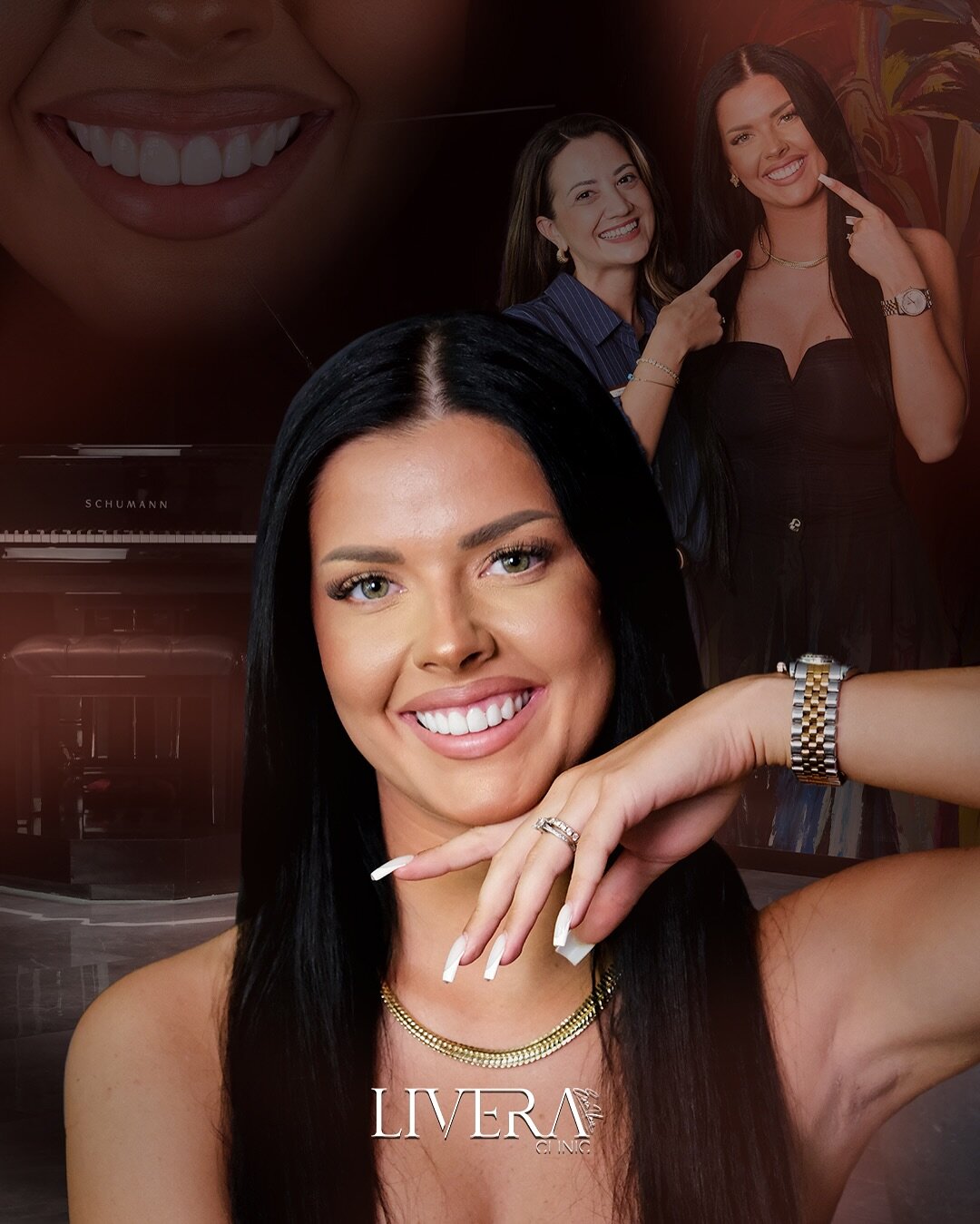 Hollywood Smile