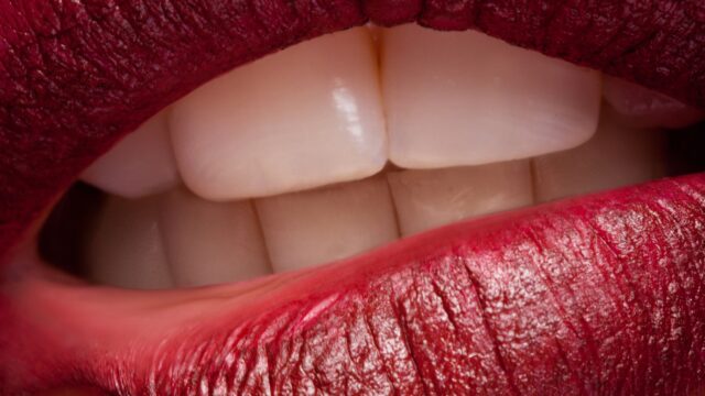 Are Dental Implants Visible When You Smile? | Livera Dental Clinic