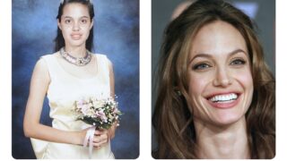 Diş rekonstrüksiyonu