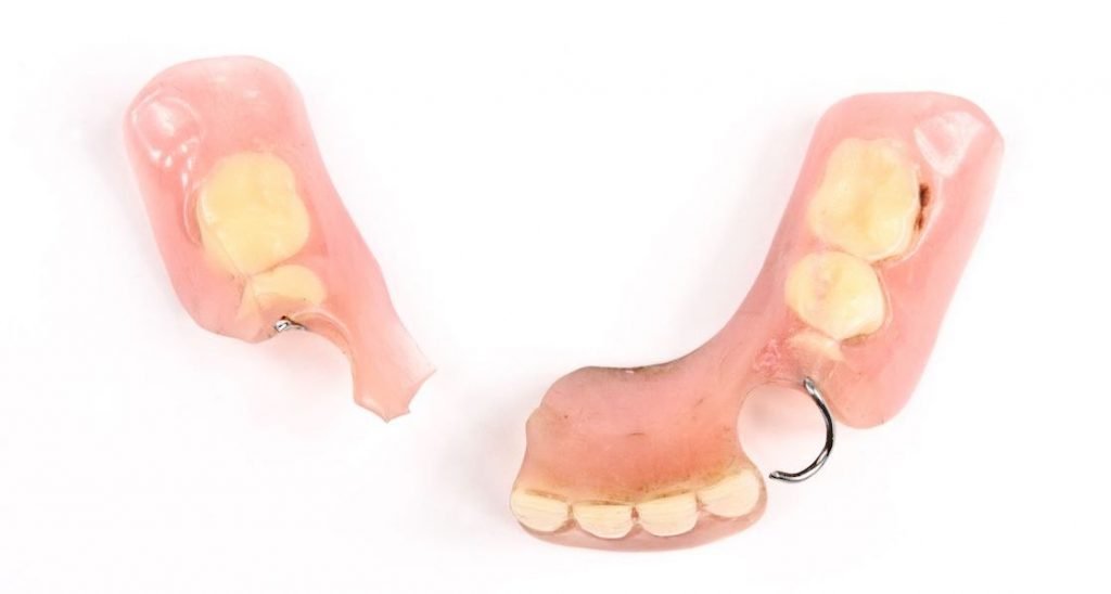 Лечение сломанного зуба