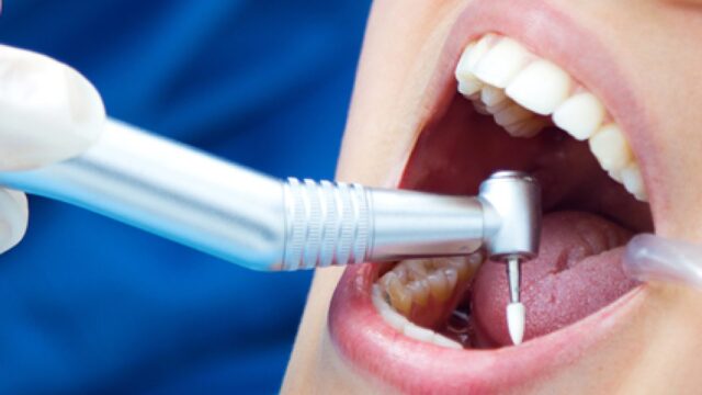 Straumann İmplantları