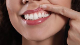 What Helps with Gum Recession? 4 gum recession