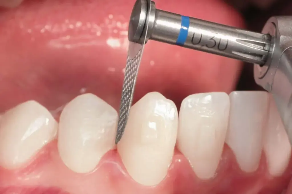 Формирование зубов