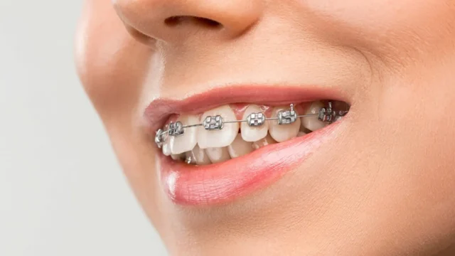 Toothlessness: Causes & Treatment Methods | Livera Dental Clinic