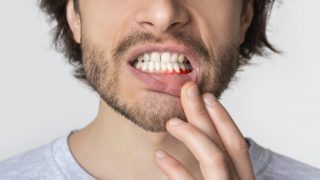 effective solutions for bleeding gums