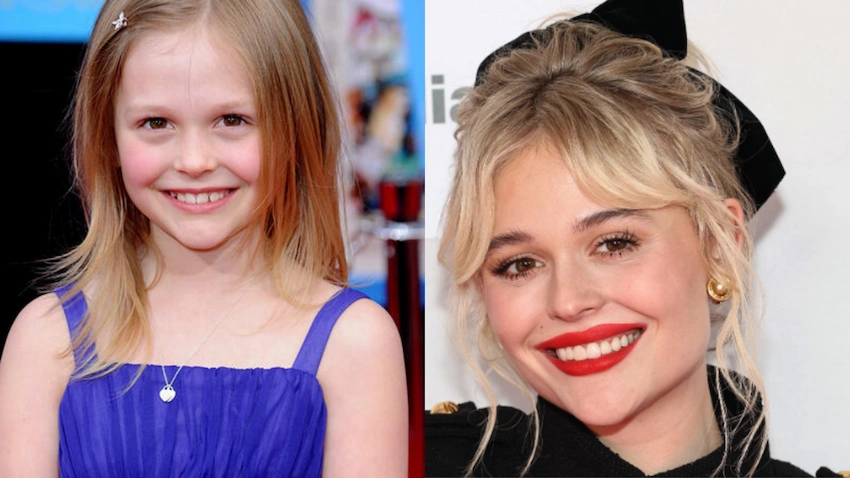 emily alyn lind teeth