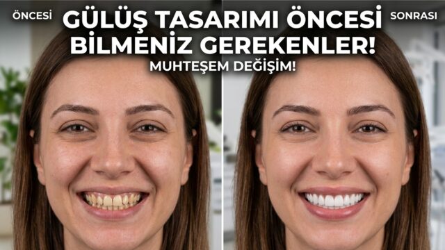 İmplant