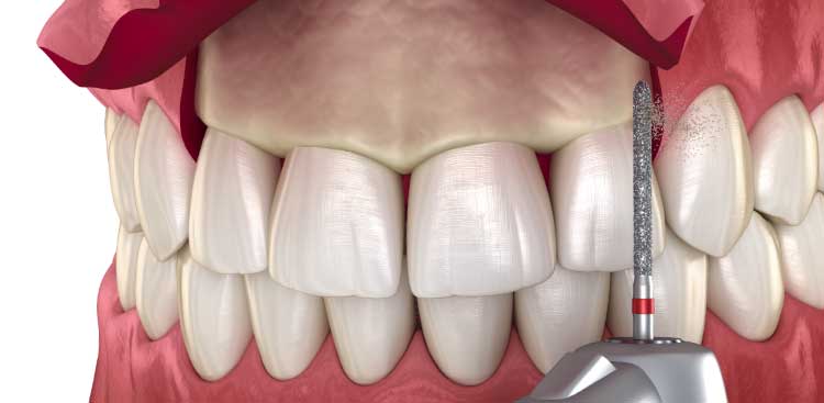 Улыбка беззубыми губами