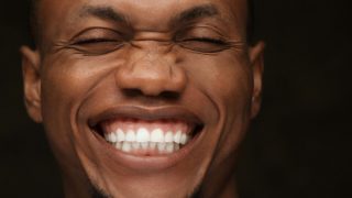 Gummy Smile Nedir? 2 gummy smile nedir