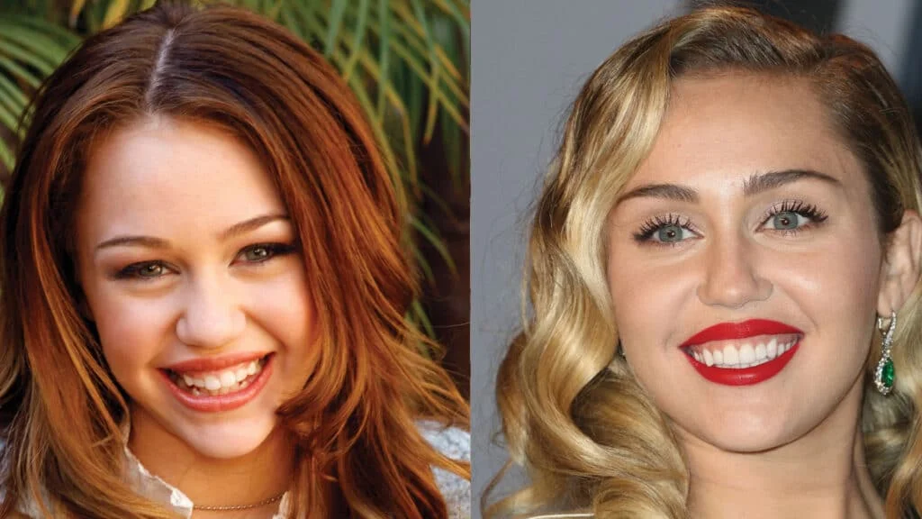 голливудская улыбка