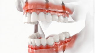 Emily Alyn Lind dişleri