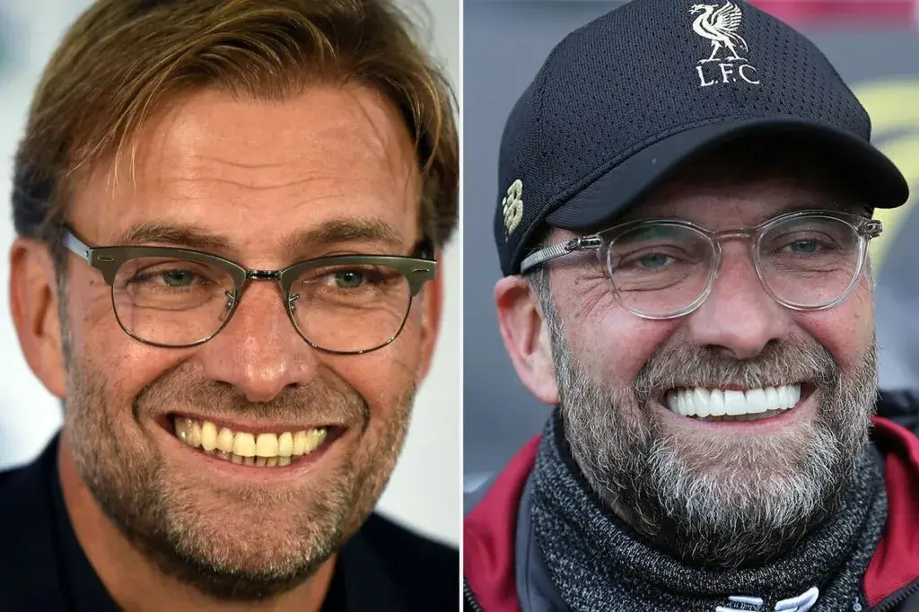 Jurgen Klopp Teeth