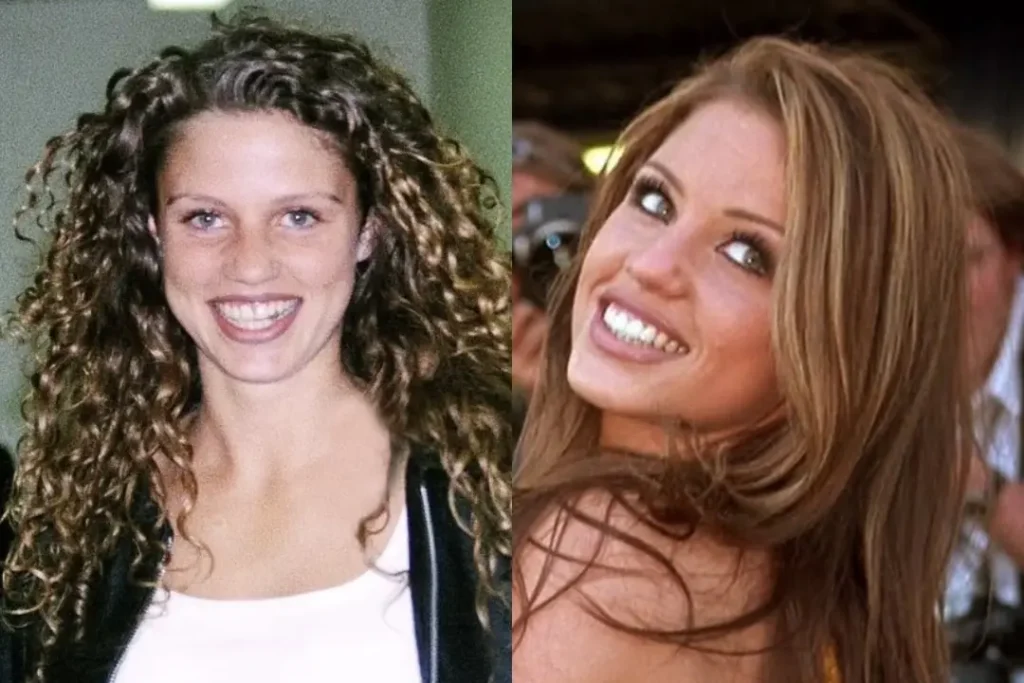 Katie Price Dişleri