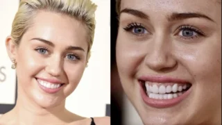 Miley Cyrus Dişleri