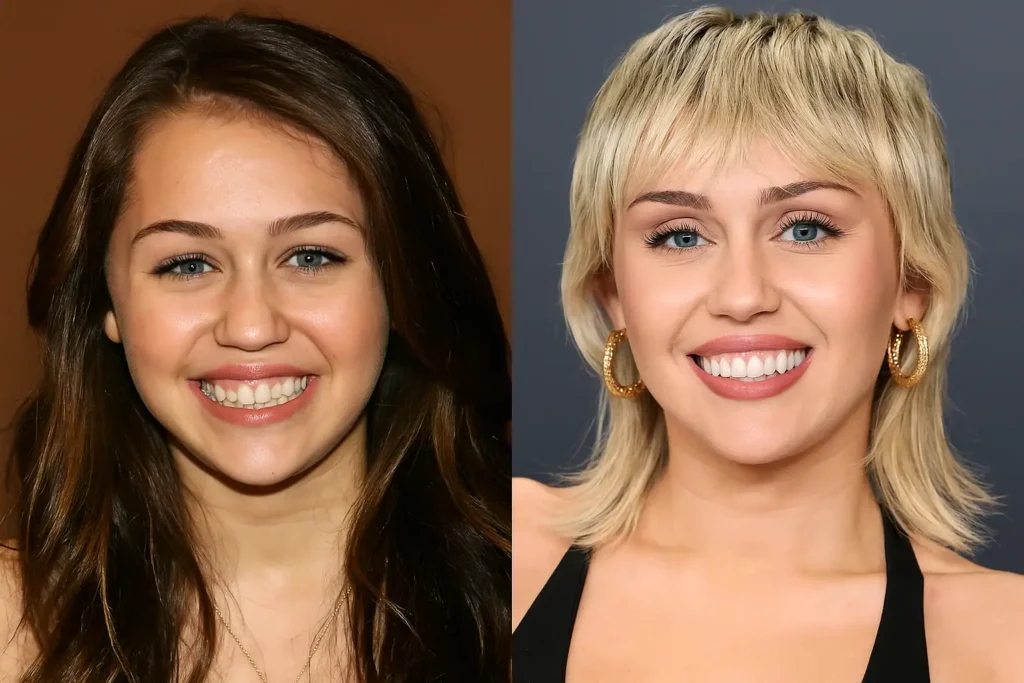 miley cyrus teeth