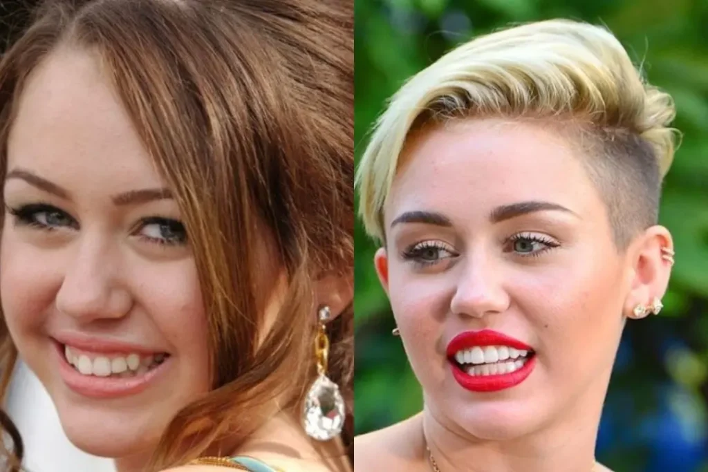 miley cyrus teeth