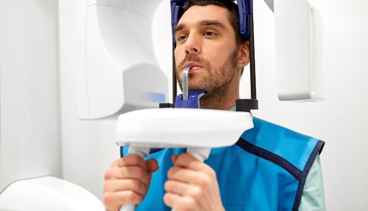 Panoramic Dental X-ray