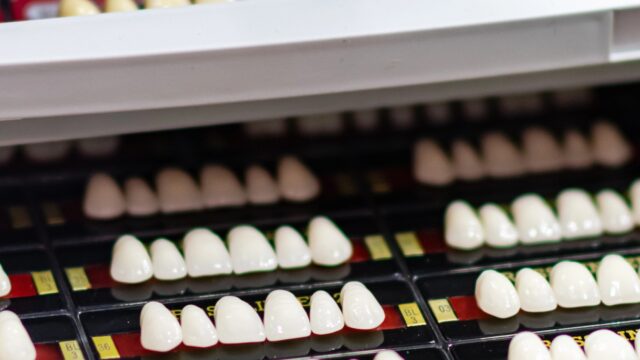 Are Veneers Permanent? How Long Do They Last? | Livera Dental Clinic