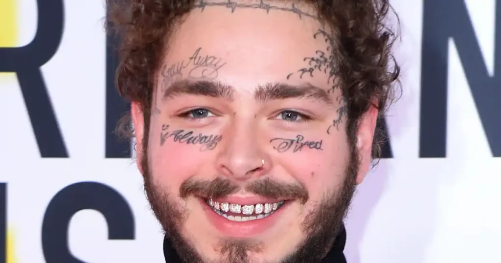 Post Malone Teeth