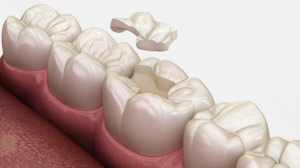 Restorative Dentistry