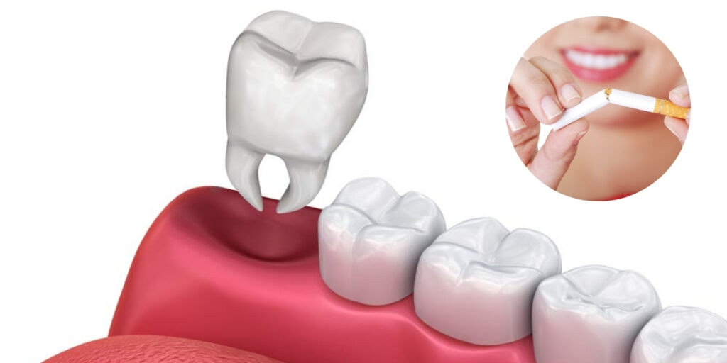 smoke after a tooth extraction