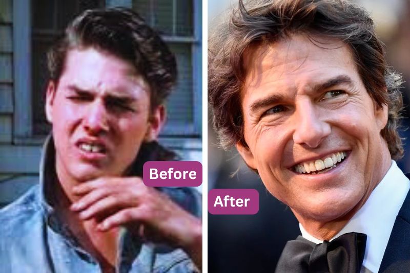 tom cruise teeth