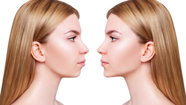 Improve Your Oral Health with Jaw Surgery | Livera Dental Clinic