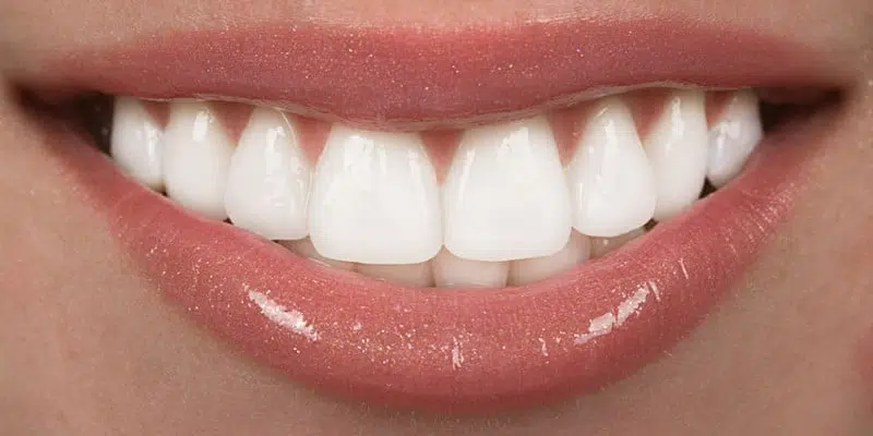 teeth