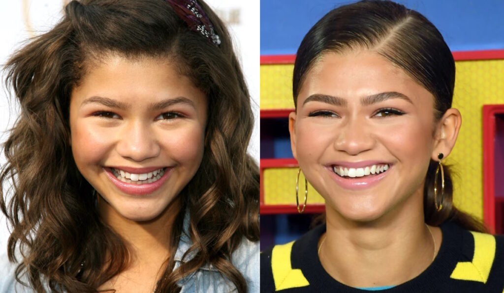 Zendaya Dişleri