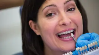 цена зубных виниров